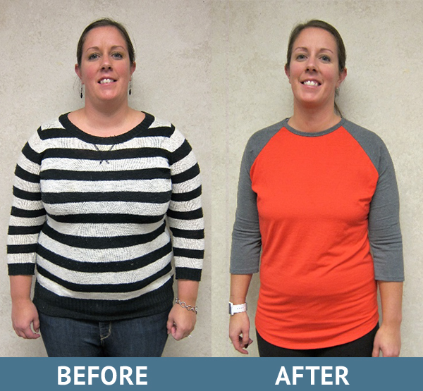 female patient with before and after photos showing success of her medical weight loss program in Milwuakee