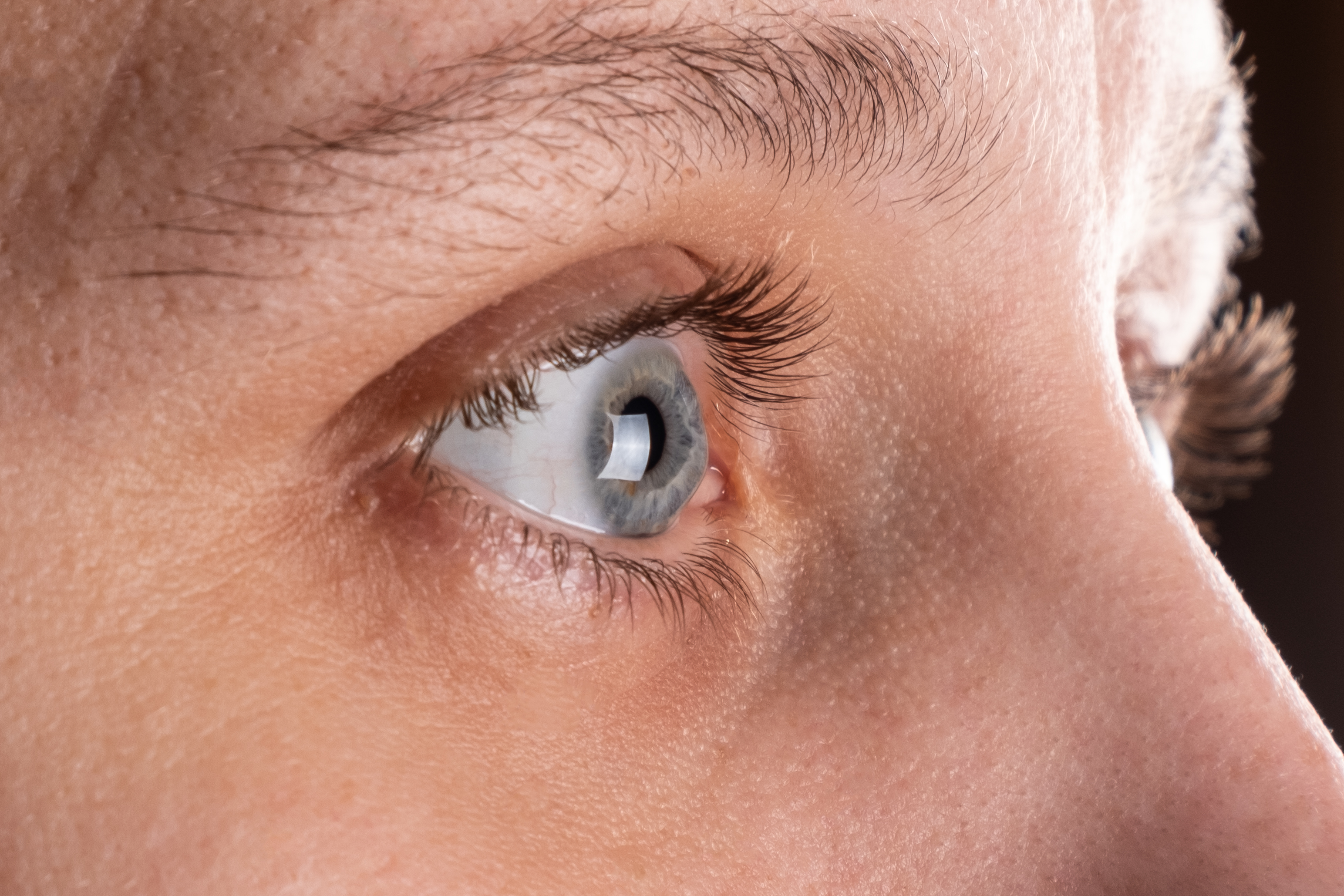 astigmatism contact lenses