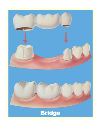 Dental Exam Image