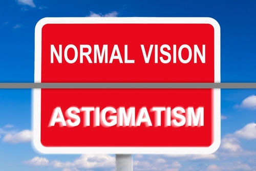 Astigmatism