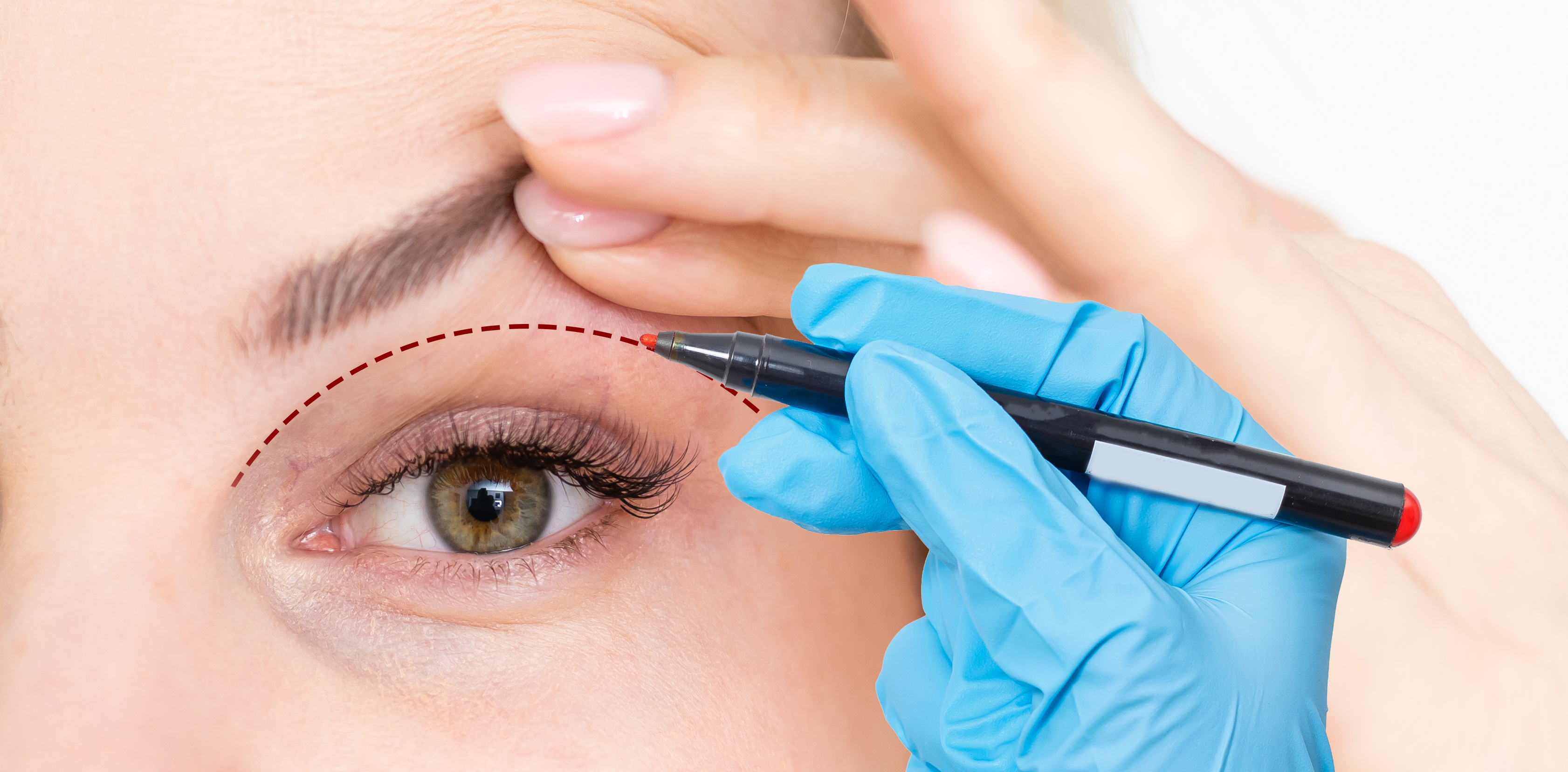 Eyelid Surgery FAQ