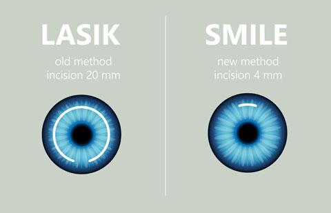 SMILE Diagram